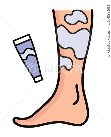 Varicose treatment icon. Violation of circulatory system. Vascular disease diagnostic. Venous insufficiency medical disease. Vector illustration Varicose treatment icon. Violation of circulatory system. Vascular disease diagnostic. Venous insufficiency medical disease. Vector illustration 110888681