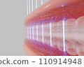 Laser shot through skin layer to collagen for Saggy skin and Facial treatment.  110914948