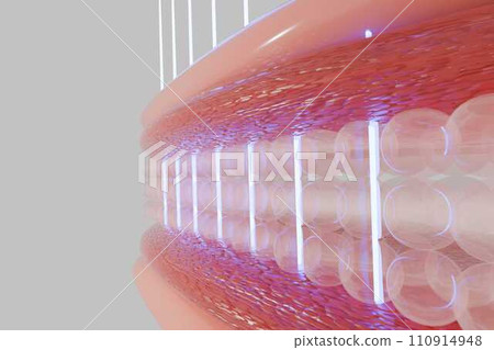 Laser shot through skin layer to collagen for Saggy skin and Facial treatment.  110914948