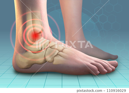 Ankle pain symptoms Ankle pain symptoms 110916029