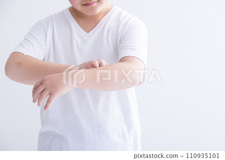 Itchy body 110935101
