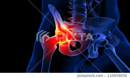Hip joint pain anatomy for medical concept 3D rendering Hip joint pain anatomy for medical concept 3D rendering 110939038