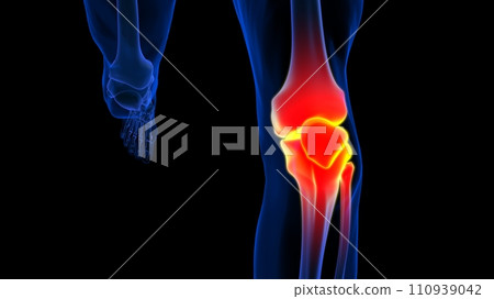 Knee joint pain anatomy for medical concept 3D rendering 110939042