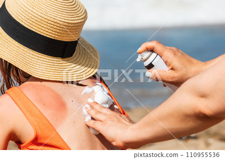 Mother applying sunburnt  relief spray to her child at a beach 110955536