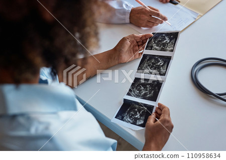 Over the shoulder of unborn baby ultrasonography picture in hands of African American woman at consultation in clinic 110958634