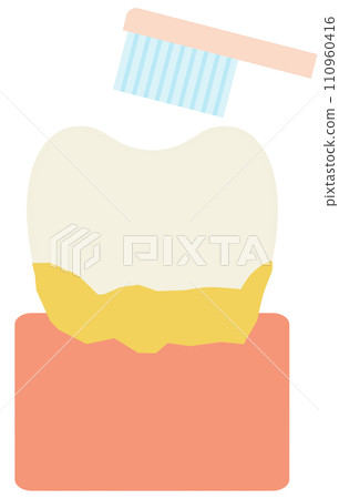 teeth and plaque teeth and plaque 110960416