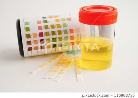 Urinalysis, urine cup with reagent strip pH paper test and comparison chart in laboratory. Urinalysis, urine cup with reagent strip pH paper test and comparison chart in laboratory. 110968753