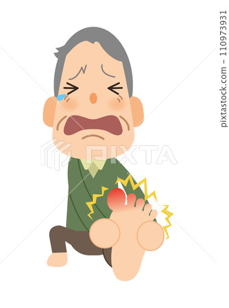 Grandpa_ Chilblains on legs 110973931