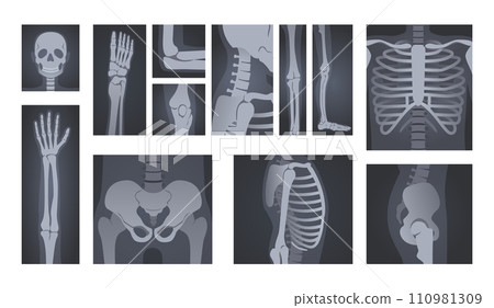 X-ray shots. Human body radiology of head skull, hand bones, spine and rib cage vector illustration set 110981309