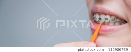 Unrecognizable Caucasian woman cleans braces with a brush. Widescreen.  110986789