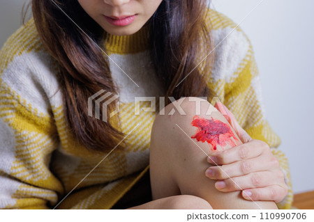 一名婦女檢查膝蓋是否有出血 110990706