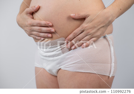 Close-up of a woman's belly after a caesarean section. A mother who recently gave birth. Close-up of a woman's belly after a caesarean section. A mother who recently gave birth. 110992276