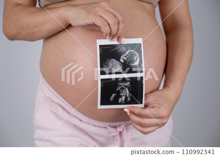 A pregnant woman holds a photo from an ultrasound screening against the background of a bare belly. A pregnant woman holds a photo from an ultrasound screening against the background of a bare belly. 110992341