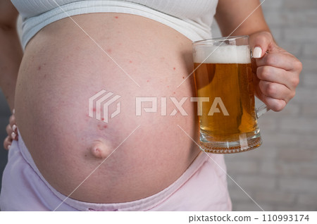Faceless pregnant woman with rash on stomach holding glass of beer. Faceless pregnant woman with rash on stomach holding glass of beer. 110993174