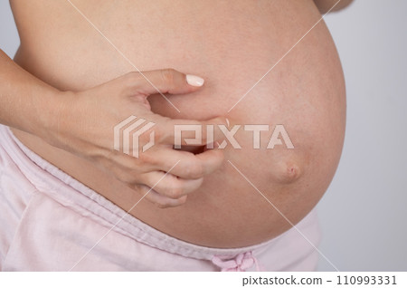 A woman scratches her stomach. Skin allergies during pregnancy. A woman scratches her stomach. Skin allergies during pregnancy. 110993331