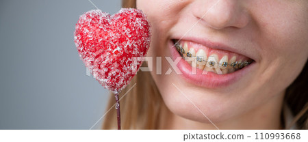Cute woman with braces on her teeth holds a candy in the form of a heart on white background. Widescreen.  110993668