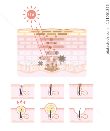 Mechanism of stains and acne 111001836