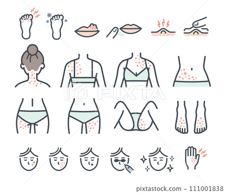 女性皮膚炎的部位 女性皮膚炎的部位 111001838
