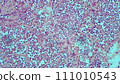 micrograph histology human lung photo a microscope 111010543