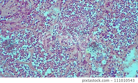 micrograph histology human lung photo a microscope micrograph histology human lung photo a microscope 111010543