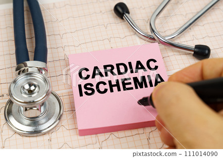 On the cardiograms there is a stethoscope and a sticker with the inscription - cardiac ischemia On the cardiograms there is a stethoscope and a sticker with the inscription - cardiac ischemia 111014090