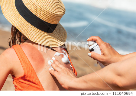 Mother spraying sunburnt  relief foam to her child at a beach 111040694