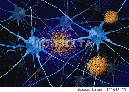 Amyloid Targeted Therapy Amyloid Targeted Therapy 111048453