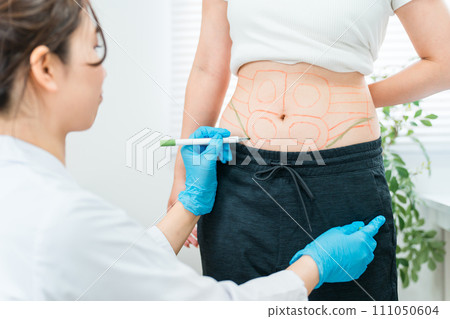 Cosmetic surgery doctor/cosmetic surgeon marking and simulating liposuction Cosmetic surgery doctor/cosmetic surgeon marking and simulating liposuction 111050604