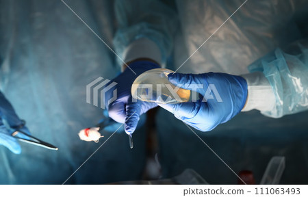 Surgeons hands holding breast implants and tools 111063493