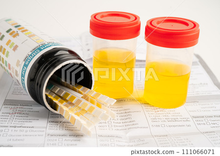 Urinalysis, urine cup with reagent strip pH paper test and comparison chart in laboratory. 111066071