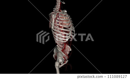 Common arterial trunk is a defect in which a single great artery 111089127