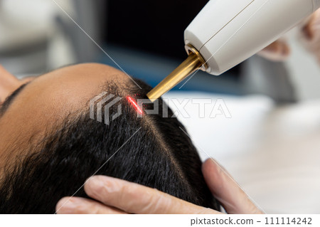 Patient in a beauty clinic having laser procedures for hair Patient in a beauty clinic having laser procedures for hair 111114242