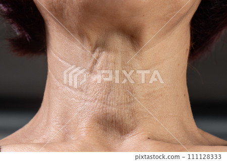Neck wrinkles and lines of senior woman. Facial and Neck Skin Aging Change on senior woman. Neck wrinkles and lines of senior woman. Facial and Neck Skin Aging Change on senior woman. 111128333
