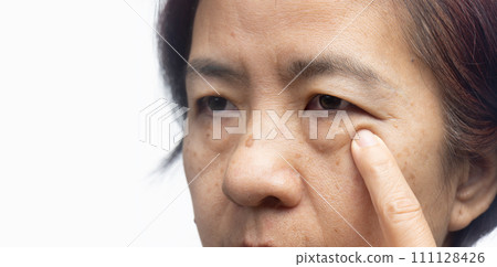 Senior asian woman worry about eye bags and dark spot. 111128426