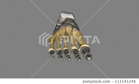 The metatarsal bones are the bones of the forefoot that connect the distal aspects of the cuneiform The metatarsal bones are the bones of the forefoot that connect the distal aspects of the cuneiform 111141248