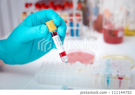Researchers test blood samples in the laboratory. Researchers are inventing vaccines to treat COVID-19 virus. Researchers test blood samples in the laboratory. Researchers are inventing vaccines to treat COVID-19 virus. 111144782