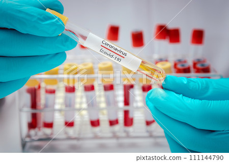 Test tubes containing plasma extracted from the blood of people who had been ill with coronavirus, COVID-19. For use in making medicines or vaccines. Test tubes containing plasma extracted from the blood of people who had been ill with coronavirus, COVID-19. For use in making medicines or vaccines. 111144790