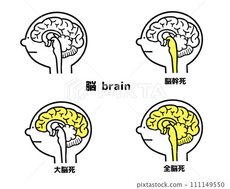 腦死模式圖 腦死模式圖 111149550
