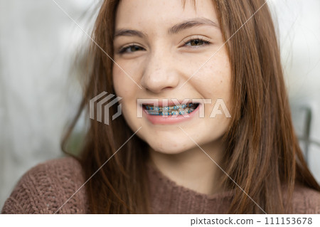 Close up portrait of face young caucasian beautiful woman blond hair smiling with braces 111153678