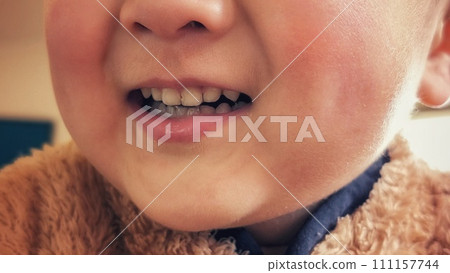 孩子的嘴巴特寫 孩子的嘴巴特寫 111157744