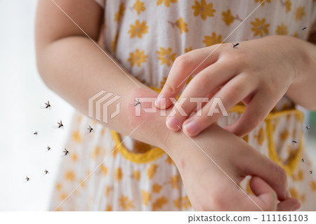 Little girl has skin rash allergy and itchy on her arm from mosquito bite Little girl has skin rash allergy and itchy on her arm from mosquito bite 111161103