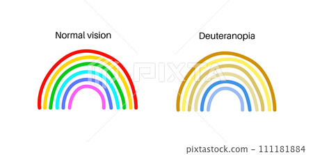 Deuteranomaly and deuteranopia Deuteranomaly and deuteranopia 111181884