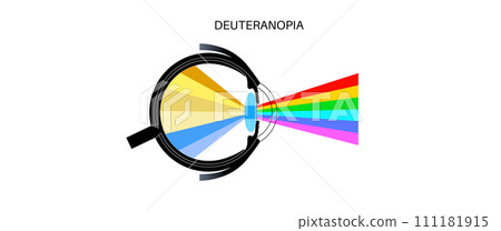 Deuteranomaly and deuteranopia 111181915