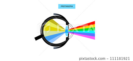 Protanomaly and protanopia Protanomaly and protanopia 111181921