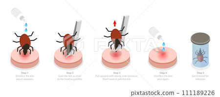 3D Isometric Flat Conceptual Illustration of How To Remove a Tick 3D Isometric Flat Conceptual Illustration of How To Remove a Tick 111189226