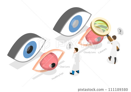 3D Isometric Flat  Conceptual Illustration of Cataract 111189380