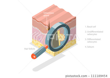 3D Isometric Flat Conceptual Illustration of Sebaceous Gland 3D Isometric Flat Conceptual Illustration of Sebaceous Gland 111189454