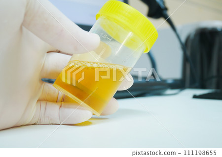 Urine analysis in laboratory. 111198655