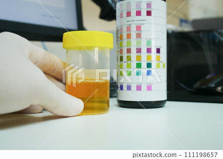 Urine analysis in laboratory. 111198657