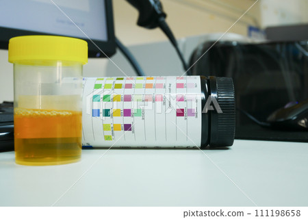 Urine analysis in laboratory. Urine analysis in laboratory. 111198658